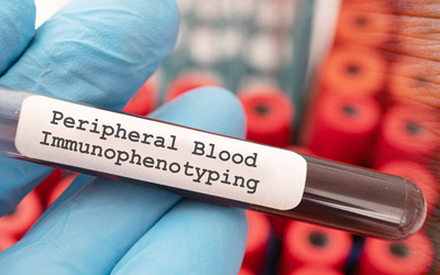 blood sample held by gloved hand